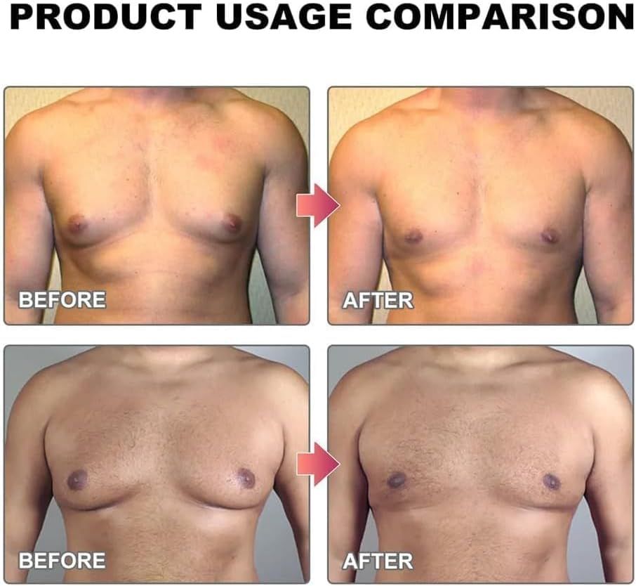 Men Therm Bee Venom Gynecomastia Heating Oil